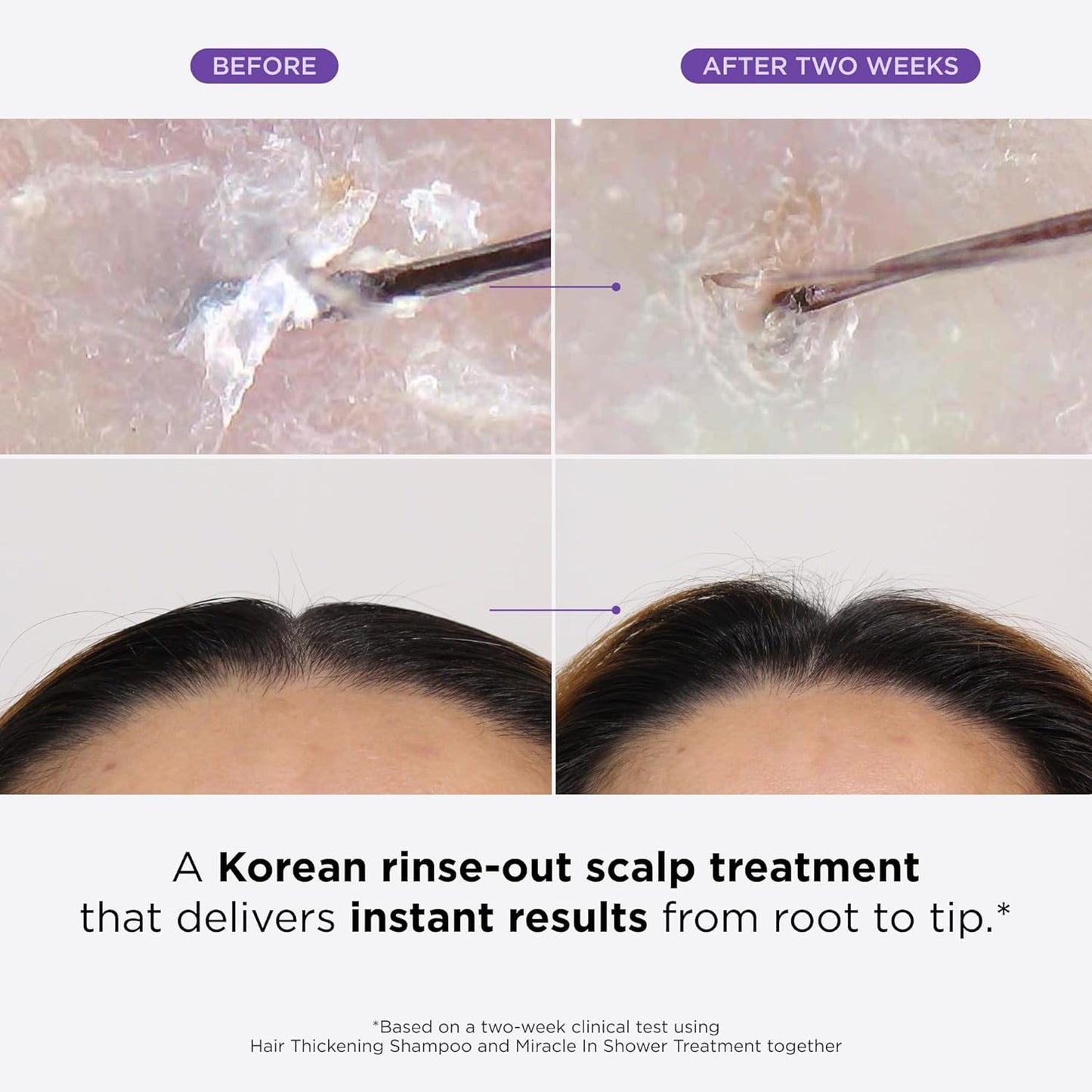 Dr. Groot Miracle in Shower Treatment